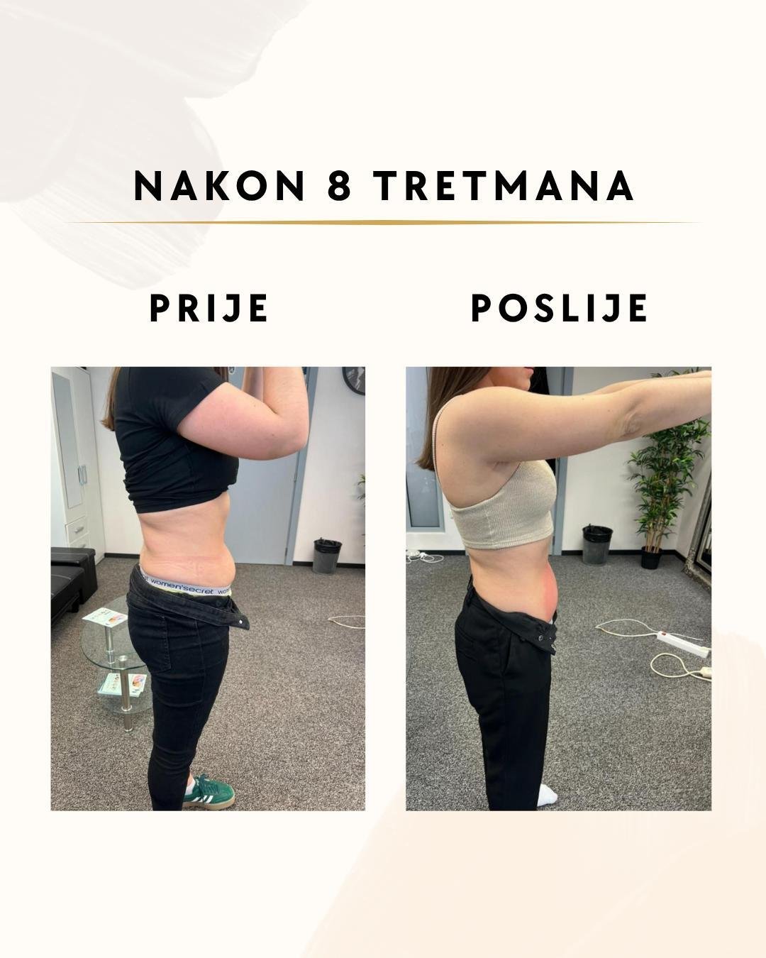 Tretmani za mršavljenje - 8 tretmana